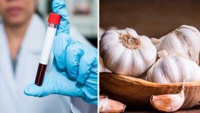 propriedades curativas do alho bau das dicas Propriedades curativas do alho | Bau das DICAS
