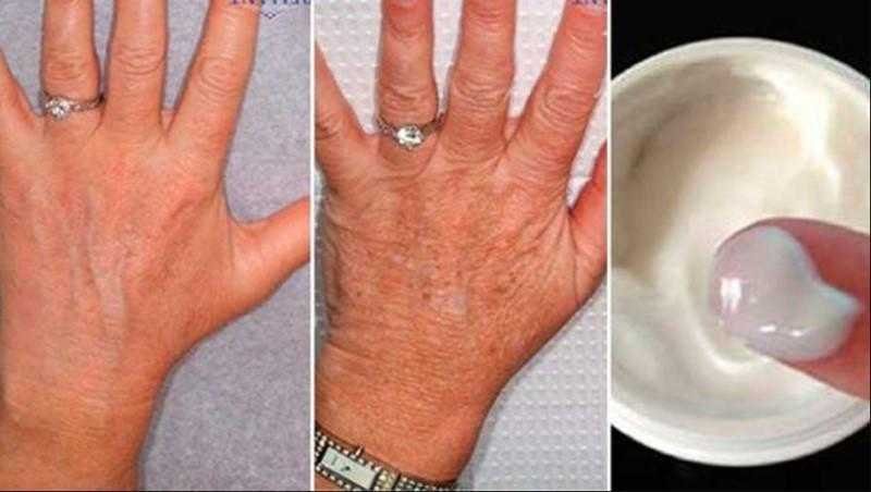 receita caseira para recuperar a maciez das maos Receita caseira para recuperar a maciez das mãos