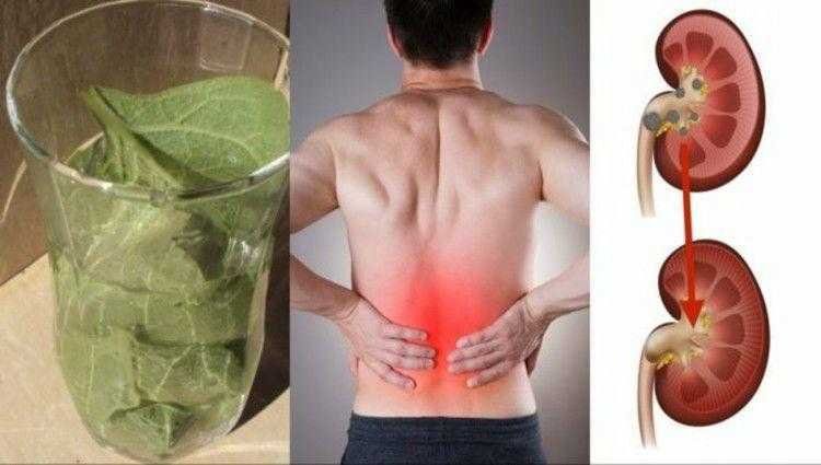 remedio caseiro para colica renal Remédio Caseiro Para Cólica Renal td