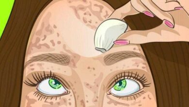 Remédio da avó para eliminar a queda de cabelo