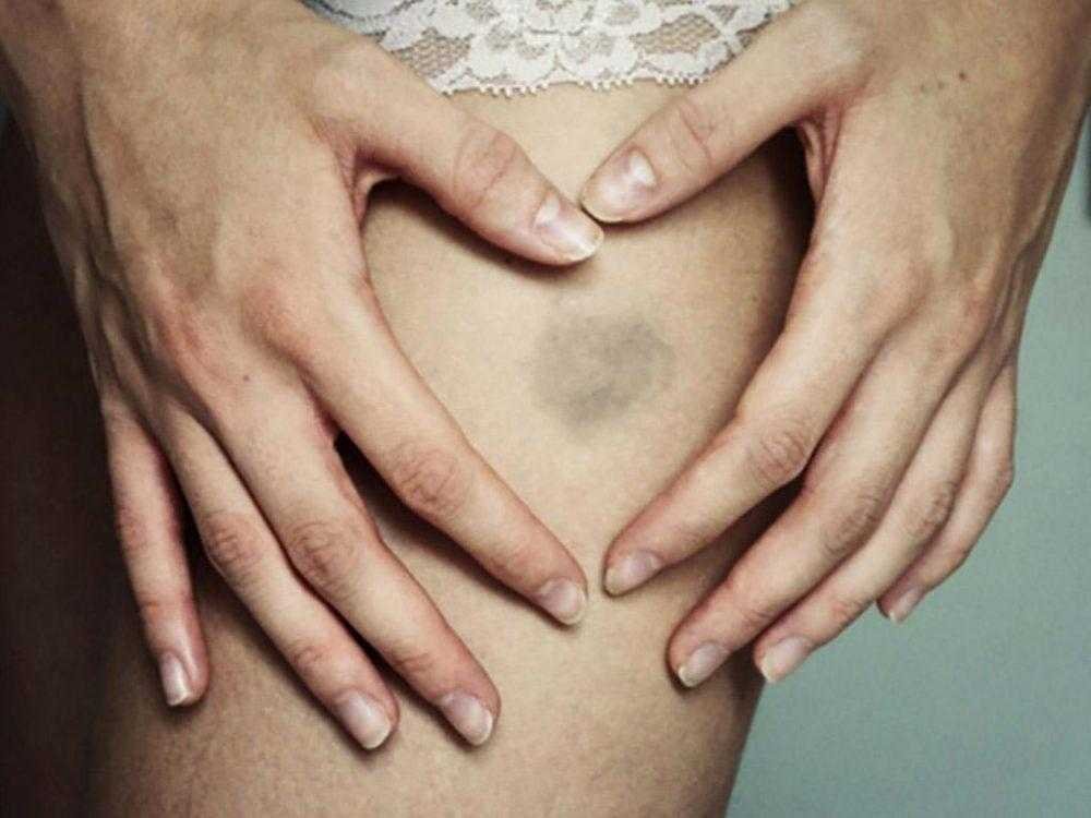 Roxo na pele do nada pode ser um alerta S