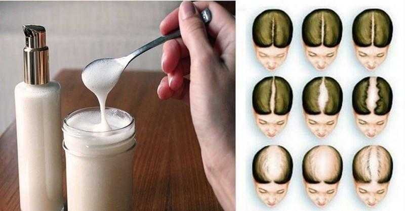 shampoo natural de bicarbonato de sodio Shampoo natural de bicarbonato de sódio