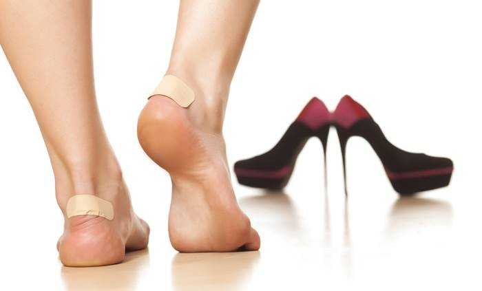 Tratamento caseiro para calos