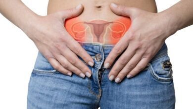 Tratamento para cisto no ovário