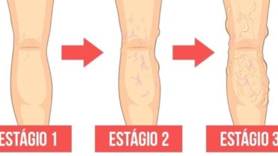 14 sinais que indicam que seu corpo esta com ma 14 sinais que indicam que seu corpo está com má circulação de sangue