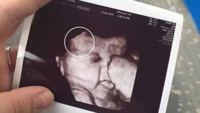 Mae fica assustada ao ver ultrassom da filha imagem mostrou