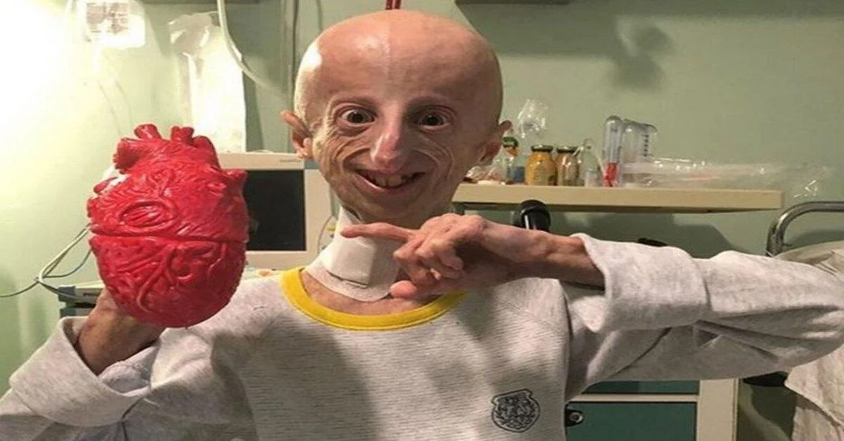 Em busca de uma cura para sua doenca jovem torna se