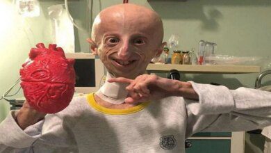 Em busca de uma cura para sua doenca jovem torna se