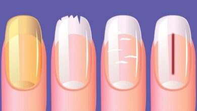 1751479208 as unhas podem revelar sintomas de cinco doencas graves entre As unhas podem revelar sintomas de cinco doenças graves, entre elas o câncer