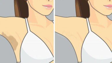 4 Dicas para clarear as axilas e as virilha