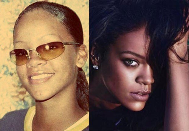 Rihanna antes e depois (Foto: Reprodução/Instagram)