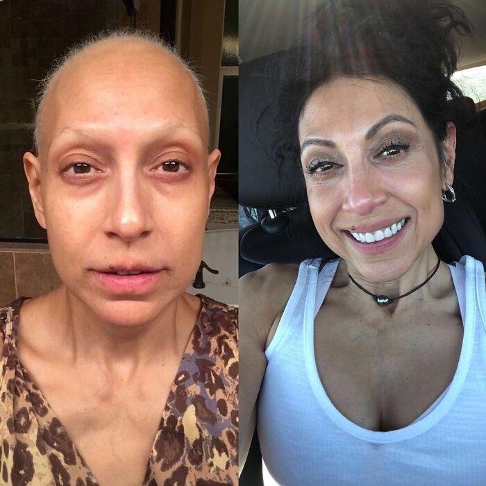 1751506846 984 22 antes e depois que sao incrivelmente satisfatorias 1634763930 692 22 Fotos de antes e depois que sao incrivelmente satisfatorias