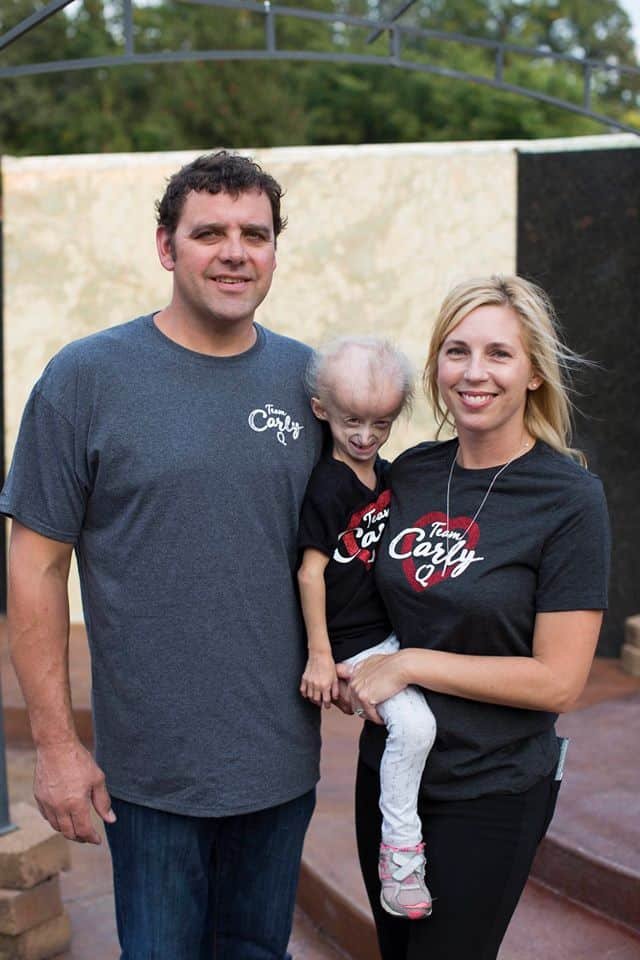 bebe envelhece rapido 1555490403 958 Bebe que envelhece 7 vezes mais rapido completa 8 anos