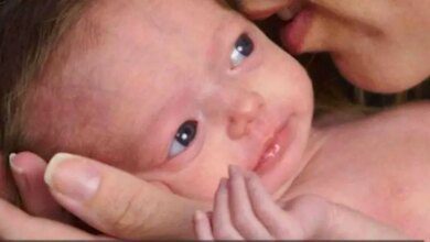 Bebê que envelhece 7 vezes mais rápido completa 8 anos! Veja ela hoje: