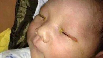 Atenção! Muito cuidado ao tirar fotos de bebés para que não aconteça o que sofreu este bebé…