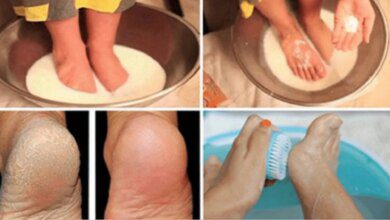 Adeus rachaduras, pés macios e bem curados