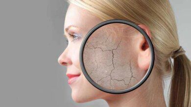 Tratamento Para Pele Seca