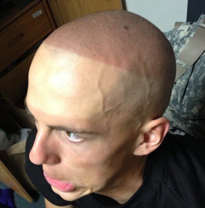 1751509387 118 23 pessoas que sabem exatamente o que o azar significa 1661293103 856 23 Pessoas que sabem perfeitamente o que o azar significa