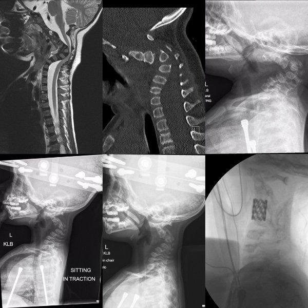 1493313311 948 medicos apertam a barriga da mae e quebram o bebe inteiro momentos depois eles descobrem o improvavel