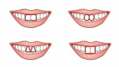 O formato dos dentes da frente revela muito sobre a sua personalidade