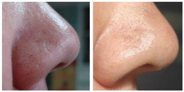 1751514839 53 8 usos do bicarbonato de sodio para ficar mais linda 5