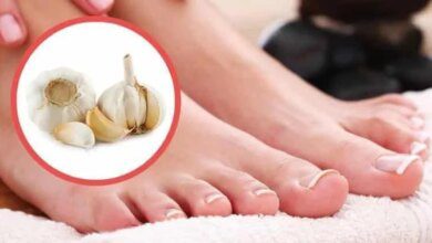 Remédios caseiros para micose de unha