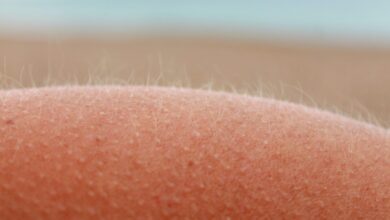 se você é mulher e tem pequenos pelos na região dos seios, deve saber disso!