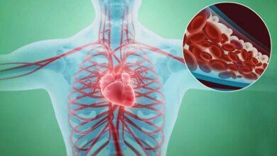 9 Sinais de que suas artérias estão entupidas