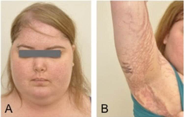 1504385328 628 6 sinais que nao devem ser ignorados se voce tem pelos no