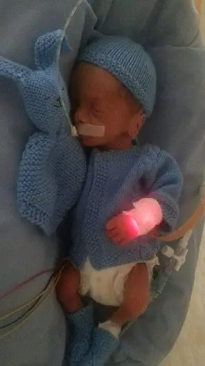 1493727083 336 este bebe pesa apenas 230g mas depois de nascido sua mae encontra isso em seu berco