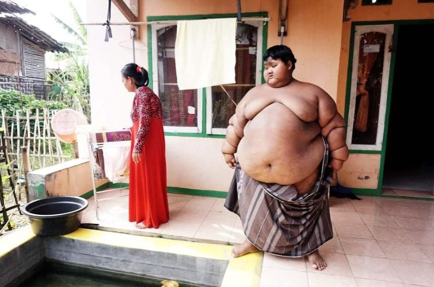 1751586007 23 menino mais gordo do mundo que pesava 190 quilos passa 1614045238 528 Menino mais gordo do mundo que pesava 190 quilos passa