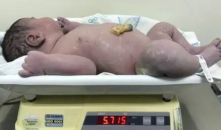1751596719 218 bebezao de quase 6kg tem alta de hospital apos 9 Bebezão de quase 6kg tem alta de hospital após nove dias: 'Muito contente', diz mãe