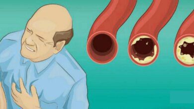 18 alimentos para limpar suas artérias e protegê-lo de ataques cardíacos