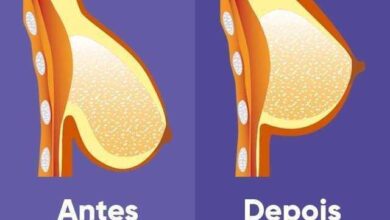 2 Receitas creme caseiro para levantar mama