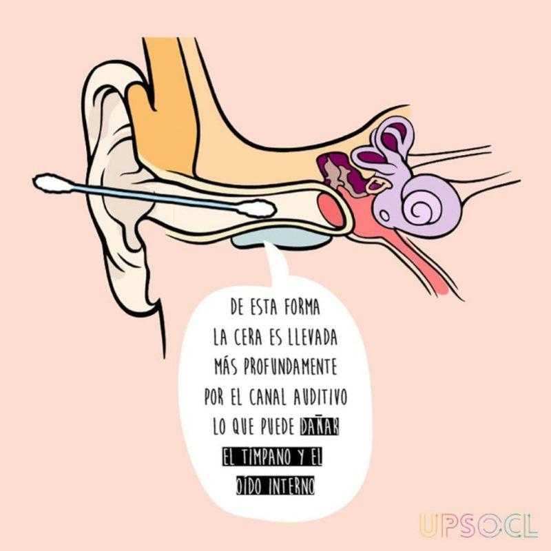 5 motivos porque nao devemos tirar a cera do ouvido 5 motivos porque nao devemos tirar a cera do ouvido