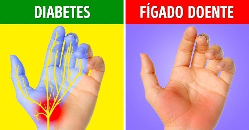 7Coisas que asmãos podem revelar sobre sua saúde