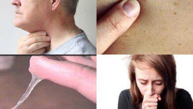 8 sinais do cancer de pulmao na fase inicial que 8 Sinais do câncer de pulmão na fase inicial que você precisa saber