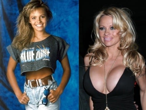 1502247948 697 veja as cirurgias plasticas que mais deram errado na historia humana