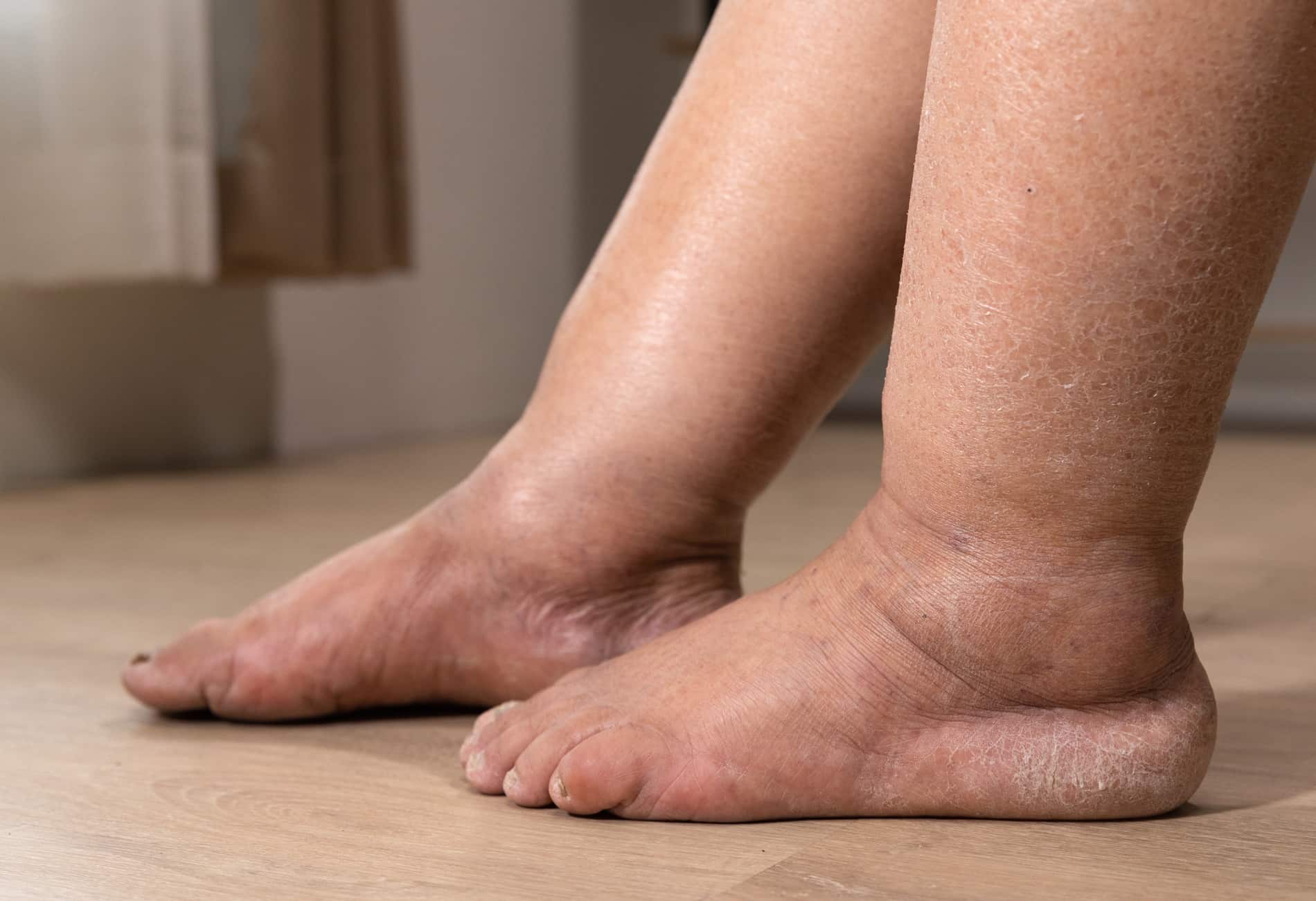 9 sinais nos pes que podem indicar problemas de saude