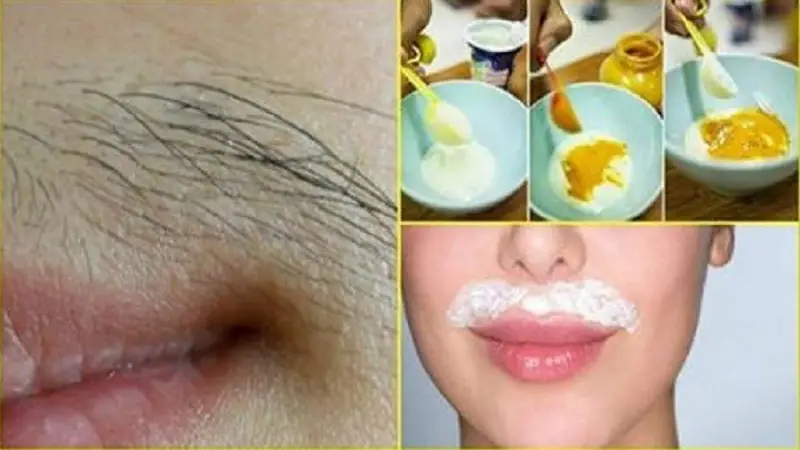 acabe de vez com os pelos do buco e do Acabe de vez com os pelos do buço e do rosto com esta receita natural!