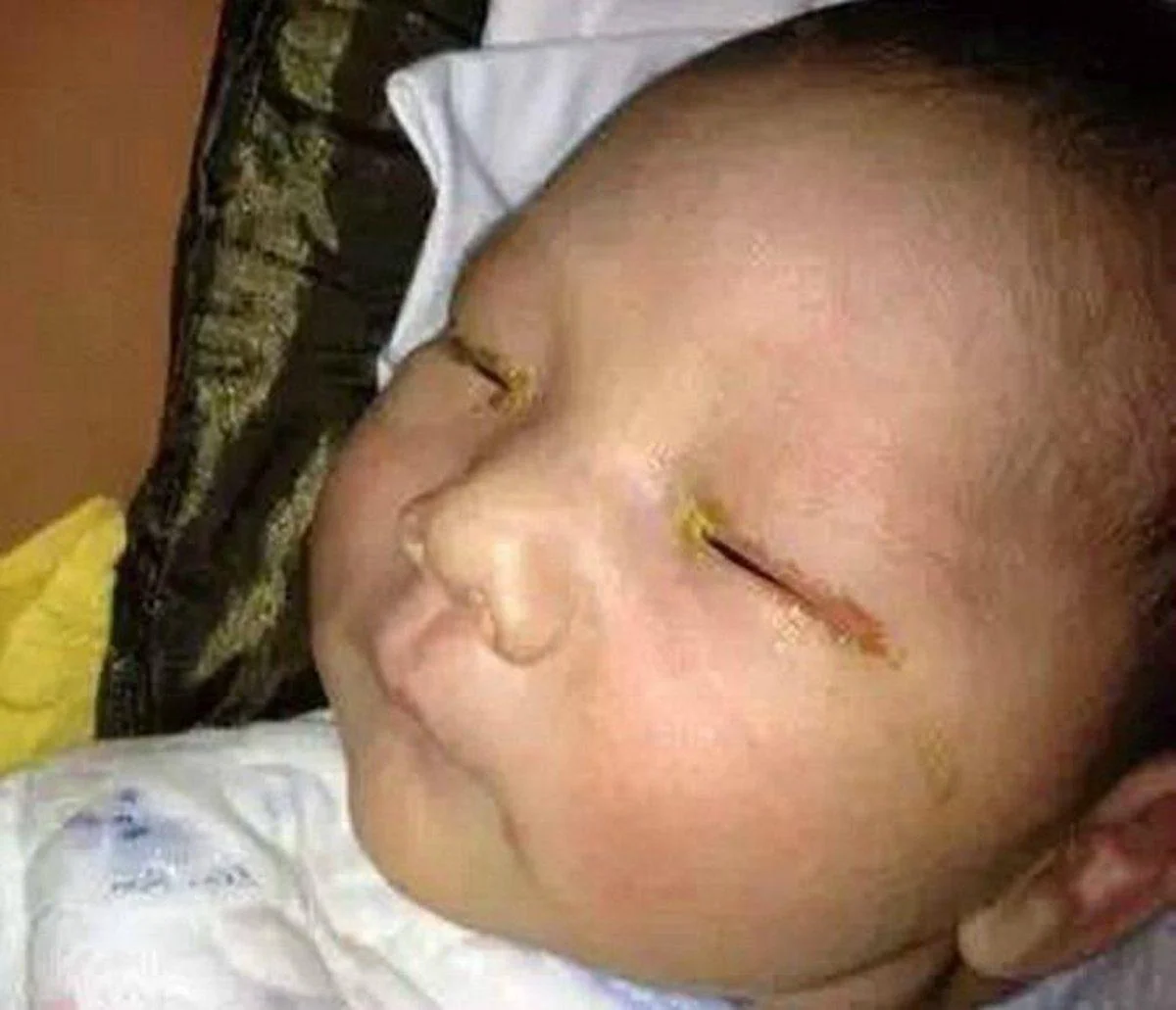 atenção! muito cuidado ao tirar fotos de bebés para que não aconteça o que sofreu este bebé…