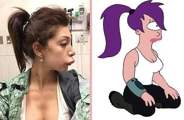 atriz fez cirurgia para ter labios da angelina jolie mas Atriz fez cirurgia para ter labios da Angelina Jolie, mas ficou a cara da Leela do Futurama!