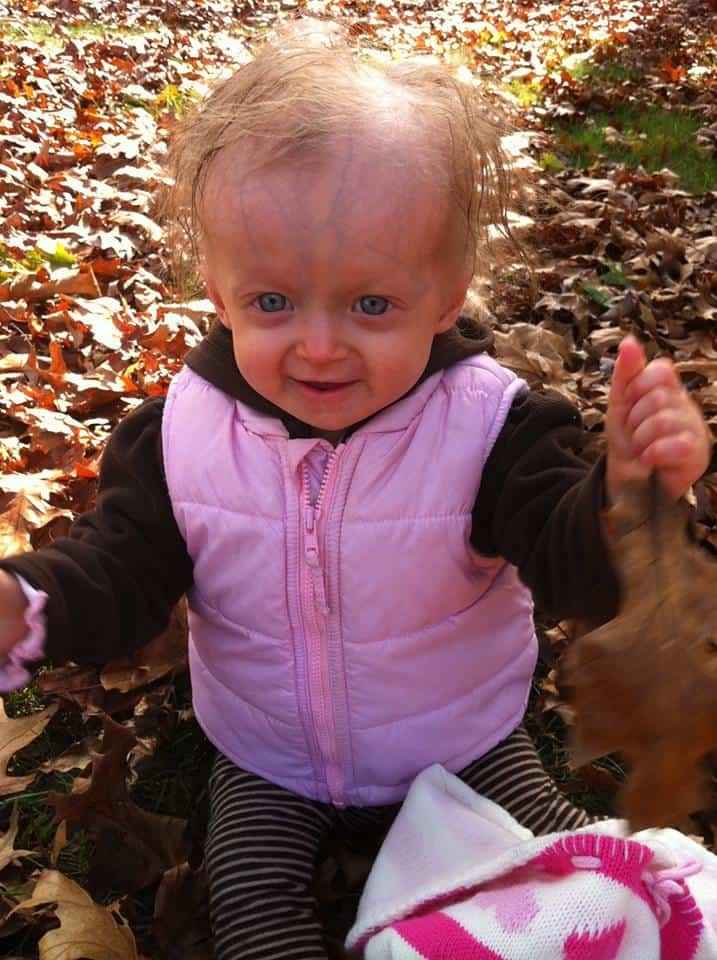 bebe envelhece rapido 1555490403 929 Bebe que envelhece 7 vezes mais rapido completa 8 anos