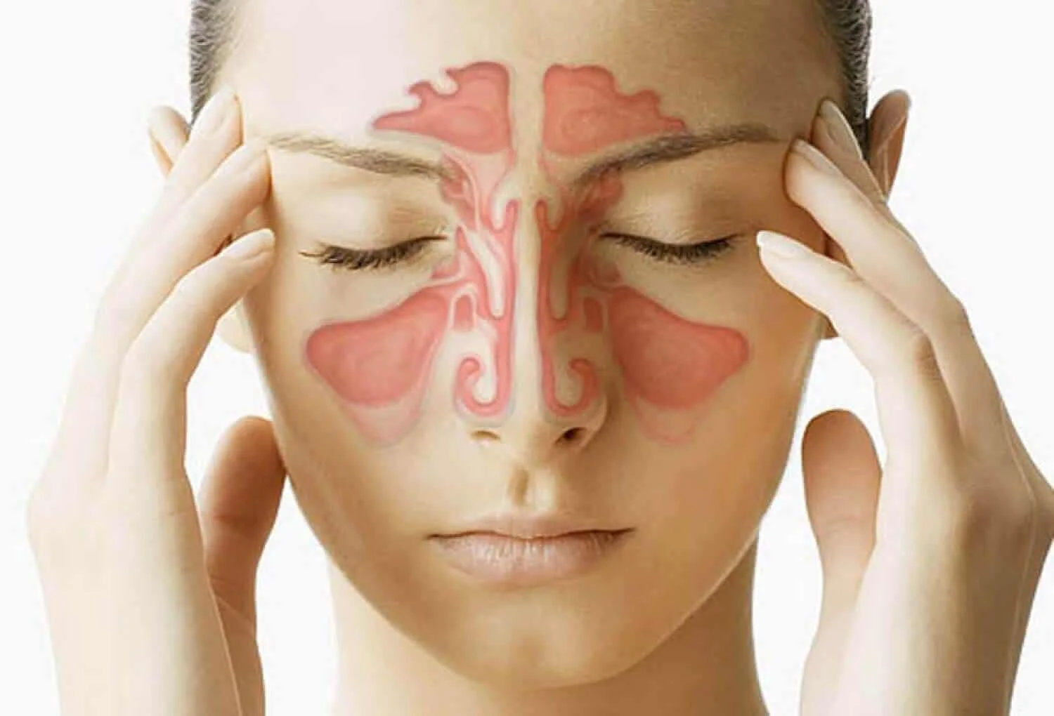 como aliviar a sinusite em 20 segundos Como aliviar a sinusite em 20 segundos