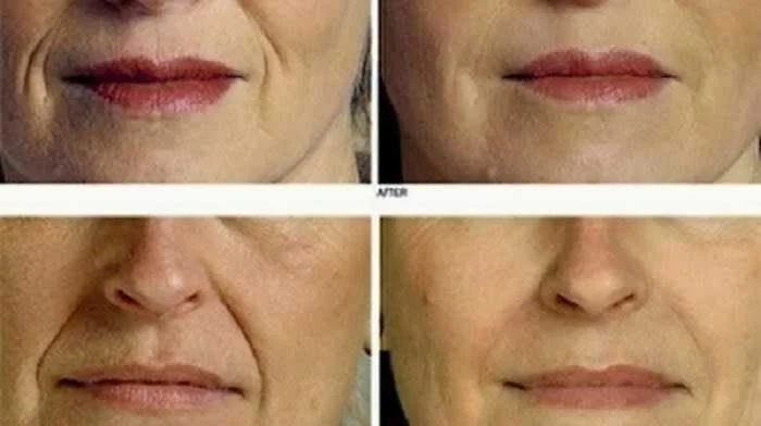 como fazer creme anti idade com 3 ingredientes Como fazer creme anti idade com 3 ingredientes