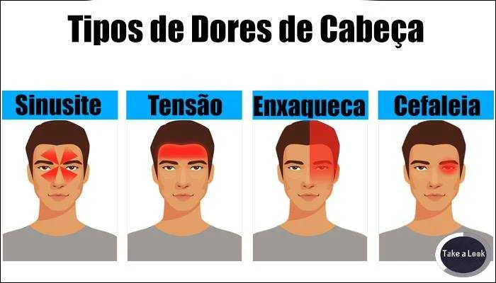 Conheça os tipos de dores de cabeça, e saiba como indentificá-las