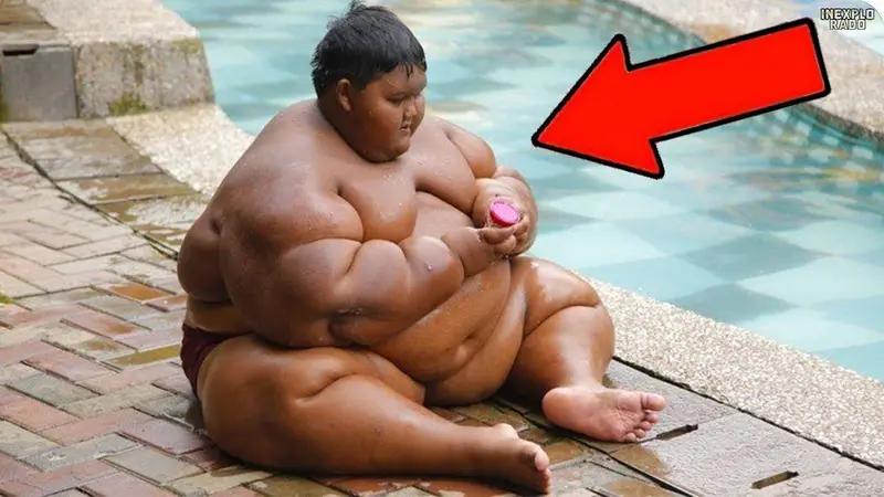 ele tem apenas 10 anos conheca a crianca mais obesa ele tem apenas 10 anos. conheça a criança mais obesa do mundo