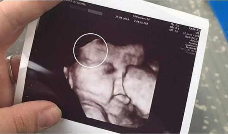 mae fica assustada ao ver ultrassom da filha imagem mostrou Mae fica assustada ao ver ultrassom da filha imagem mostrou