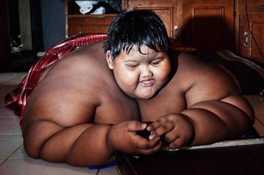 menino mais gordo do mundo que pesava 190 quilos passa Menino mais gordo do mundo que pesava 190 quilos passa