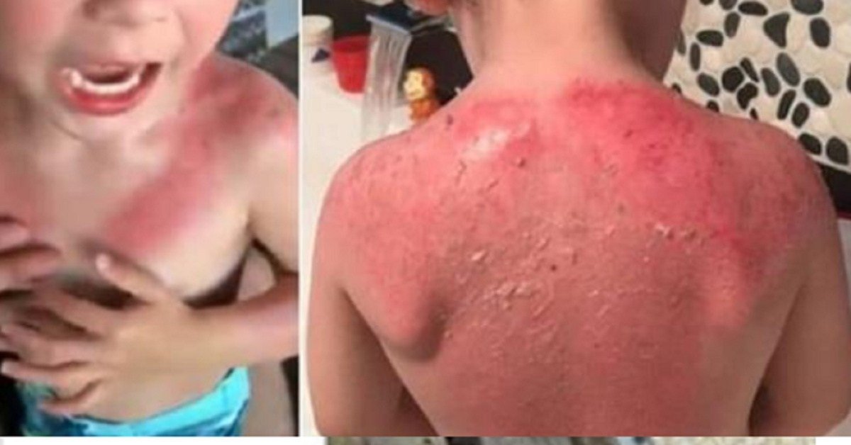 pai faz alerta sobre o protetor da peppa pig que Pai faz alerta sobre o bronzeador da Peppa Pig que